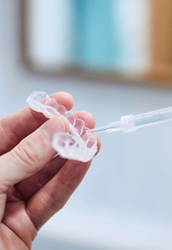 blanqueamiento-dental-domiciliario-en-casa-manresa