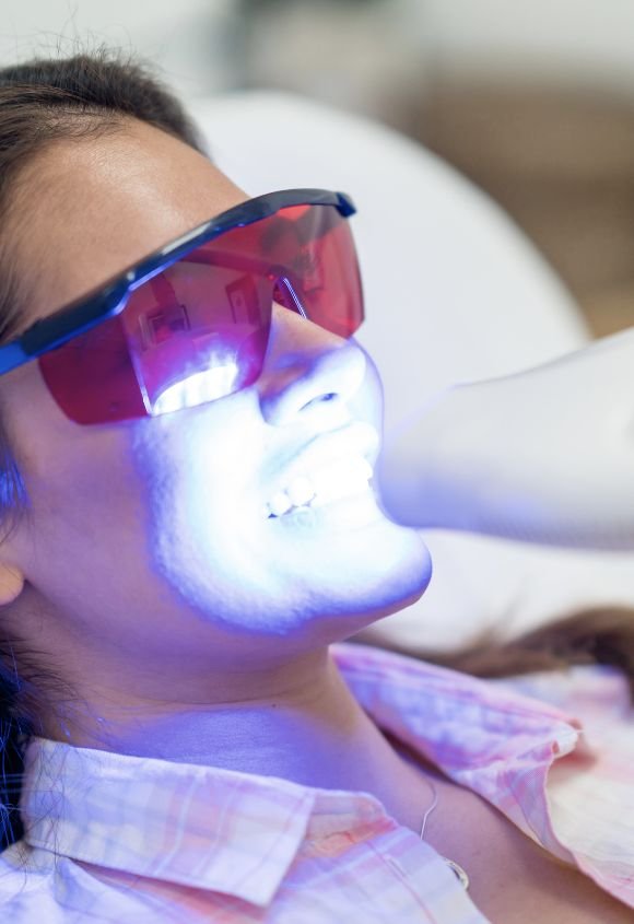 blanqueamiento-dental-en-clinica-zoom-manresa-raga