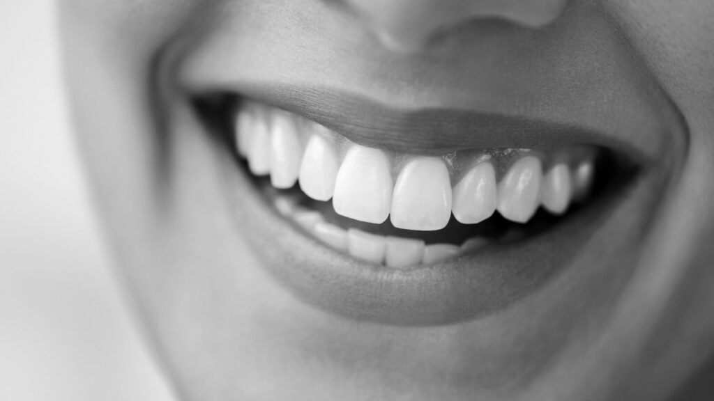 carillas-dentales-en-manresa-raga-clinica-dental