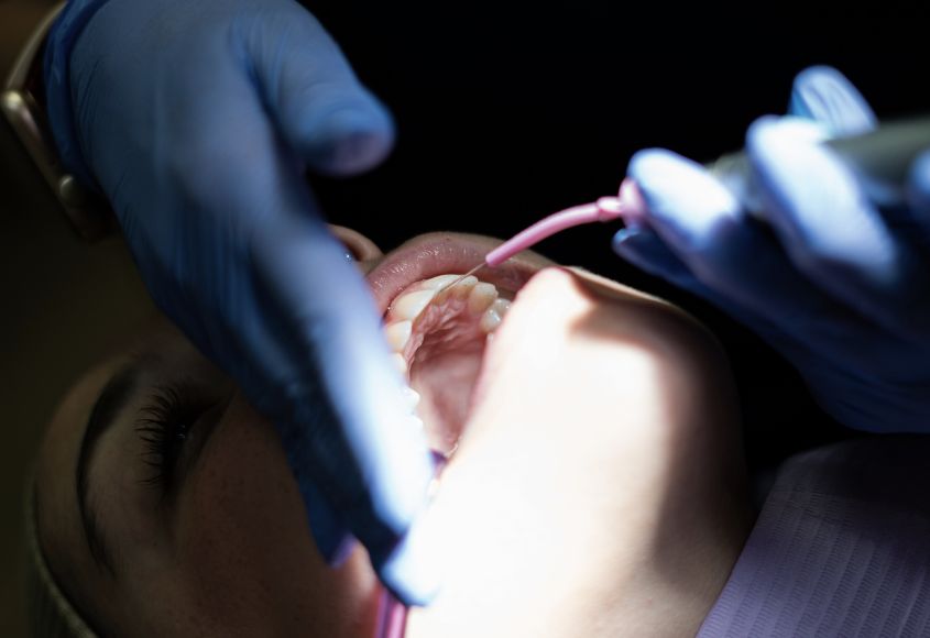 estetica-dental-manresa-tratamientos-dentales-esteticos