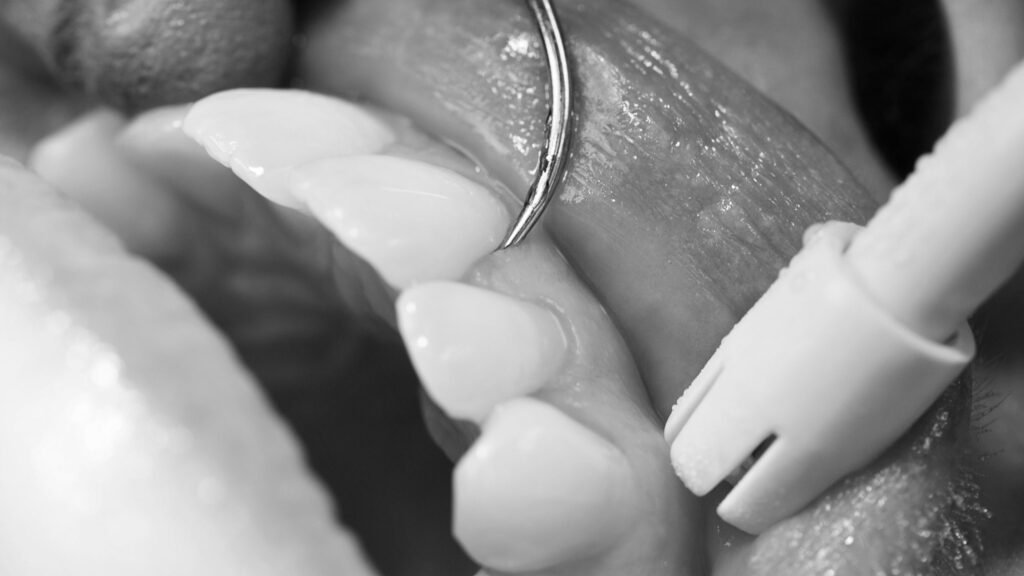 periodoncia-manresa-clinica-raga