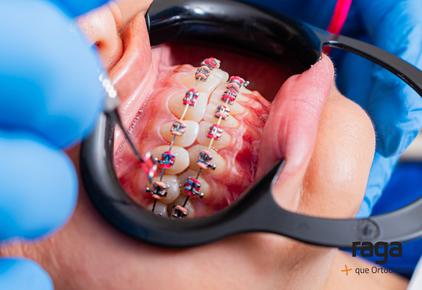 ortodoncia interceptiva