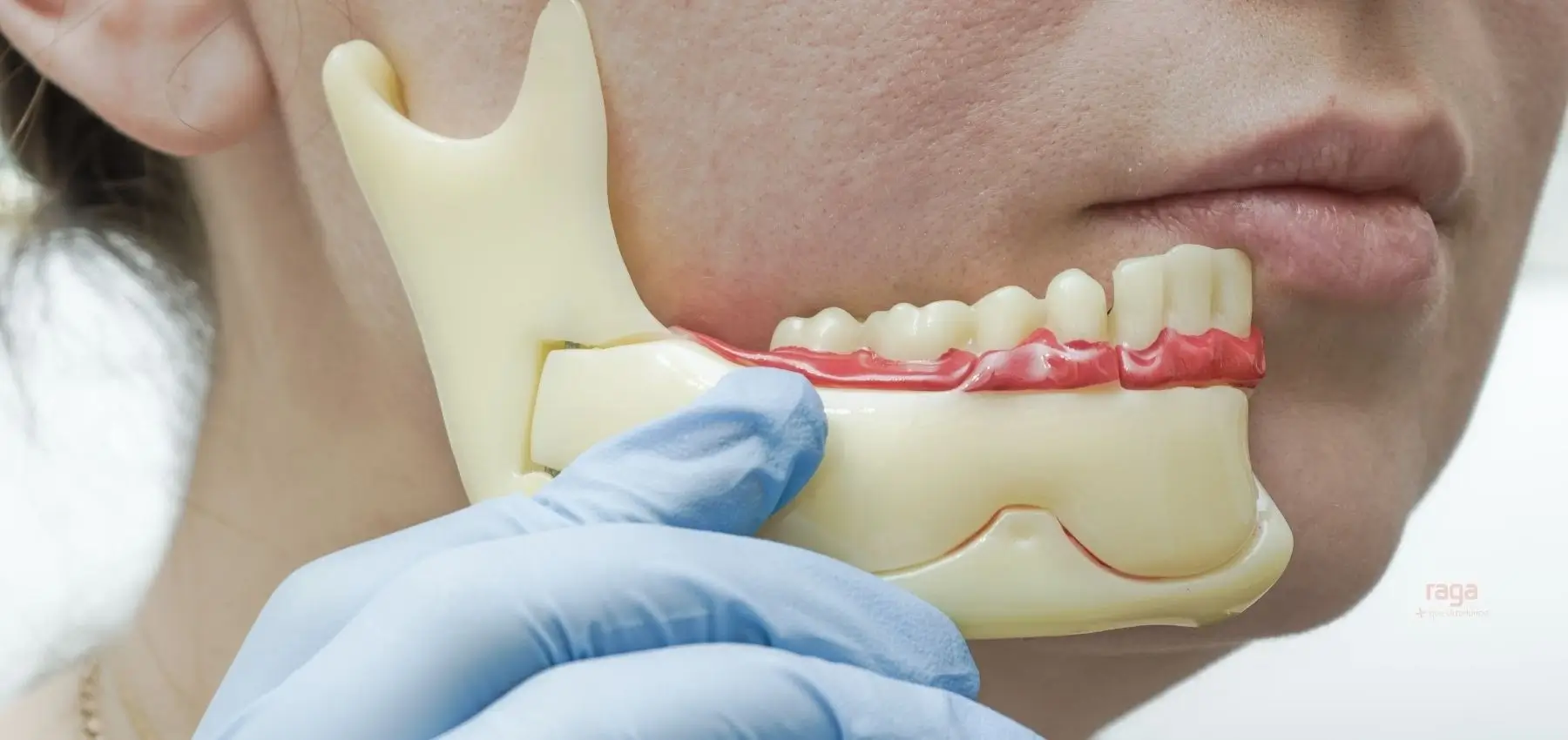 Cómo tratar el dolor de mandibula al masticar