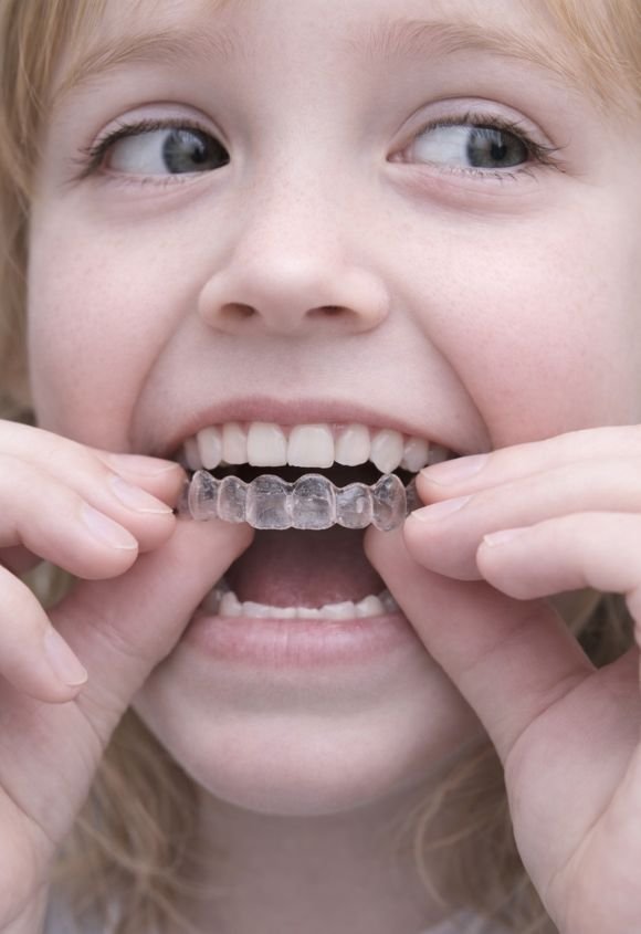 Ortodoncia invisible para niños en Raga Manresa